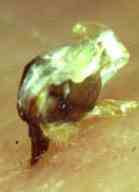 A bee sting and venom sack